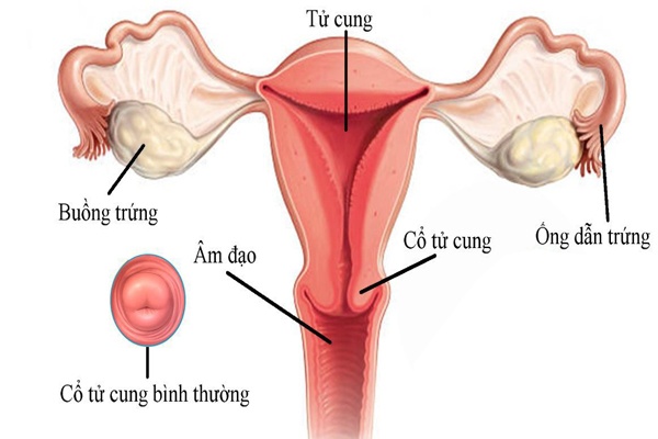 Cấu trúc của tử cung