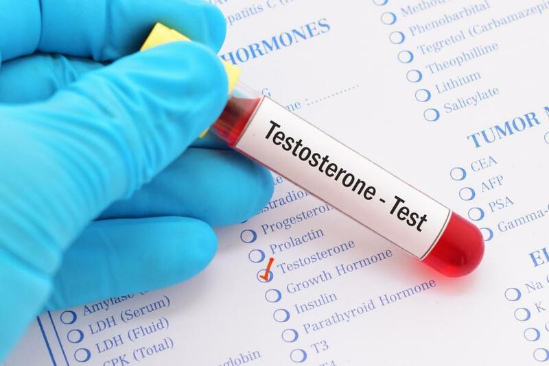 Đo nồng độ testosterone để chẩn đoán rối loạn cương dương ở những người mắc bệnh tiểu đường