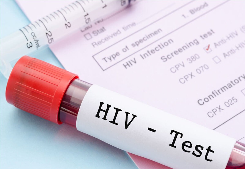 HIV làm suy yếu hệ thống miễn dịch của bệnh nhân