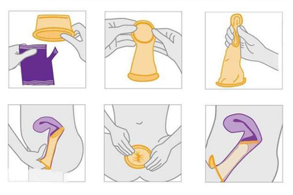 Hình ảnh minh họa các bước thực hiện đeo bao cao su nữ
